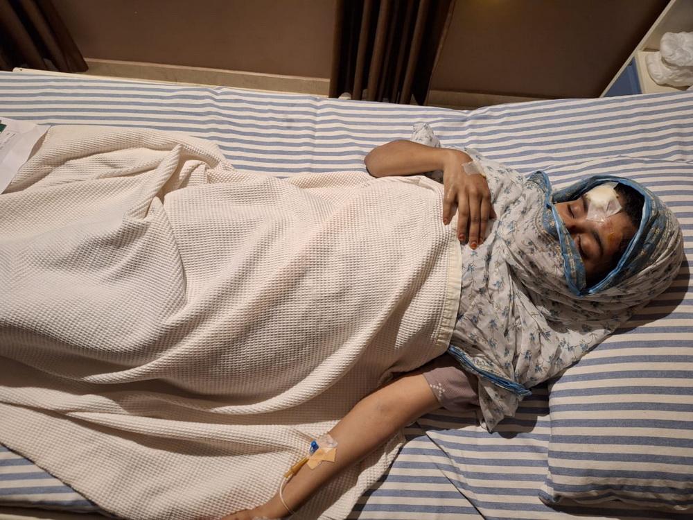 بھٹکل: سیر و سیاحت کے لیے ساگر روڈ سے آگے ہاڈولّی اور کُنٹوانی جانا پڑا مہنگا؛ حملے میں ایک خاتون سمیت دو شدید زخمی