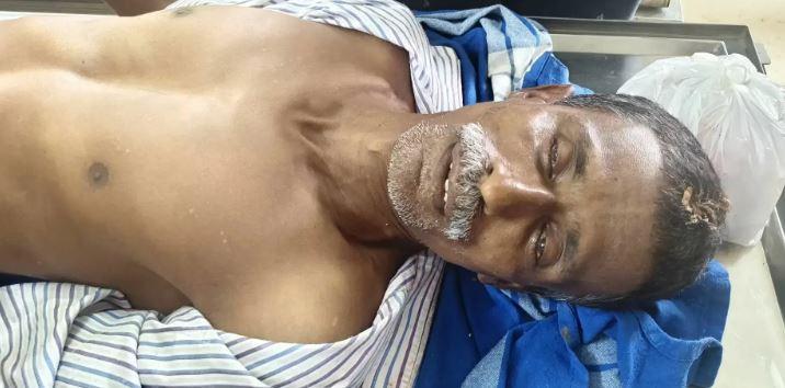 بھٹکل : پھولوں کے باغ میں کام کرتے وقت سانپ کاٹنے سے ایک شخص کی موت